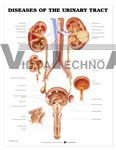 Diseases of the Urinary Tract Anatomical Chart